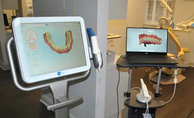 implant 5 1